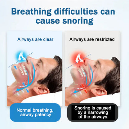Natravor® SnoreLess Nasenatmer